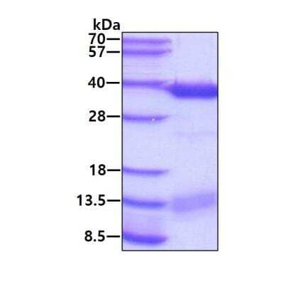 SDS-Page: Recombinant Human ABH2 Protein [NBP1-72287] - 3ug by SDS-PAGE under reducing condition and visualized by coomassie blue stain.