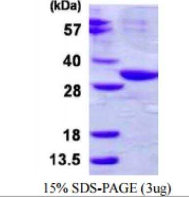 Unknown Recombinant Human ABHD10 His Protein