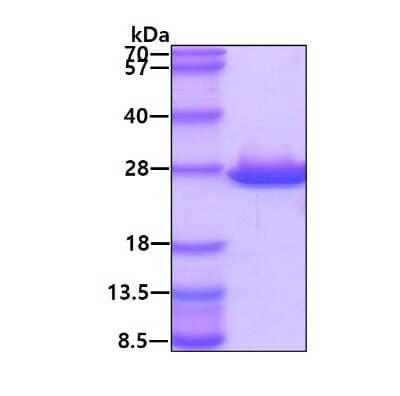 SDS-PAGE Recombinant Human ABHD14B His Protein
