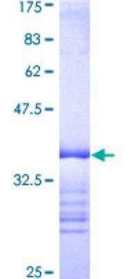 SDS-Page: Recombinant Human ABL2 Protein [H00000027-Q01] - 12.5% SDS-PAGE Stained with Coomassie Blue.