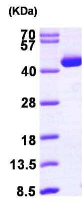 SDS-Page: Recombinant Human ACAT2 Protein [NBP1-45287] - 15% SDS-PAGE (3ug)