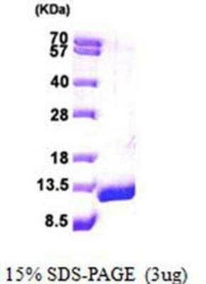 SDS-Page: Recombinant Human ACBP Protein [NBP1-50833]