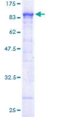 SDS-Page: Recombinant Human ACOX1 Protein [H00000051-P01] - 12.5% SDS-PAGE Stained with Coomassie Blue.