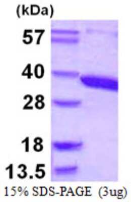 SDS-Page: Recombinant Human ACY3 Protein [NBP1-72381] - 15% SDS-PAGE (3ug)
