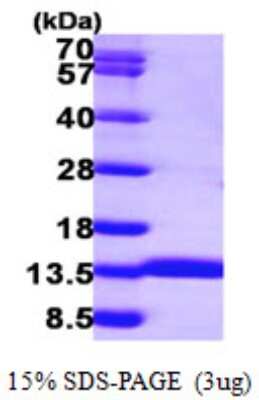 SDS-PAGE Recombinant Human ACYP1 His Protein