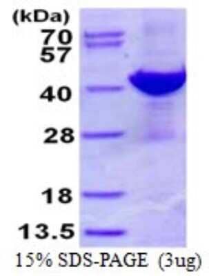 SDS-Page: Recombinant Human ADP-ribosylarginine hydrolase Protein [NBP1-98899] - 15% SDS-PAGE (3ug)