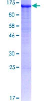 SDS-Page: Recombinant Human ADTB1 Protein [H00000162-P01] - 12.5% SDS-PAGE Stained with Coomassie Blue.