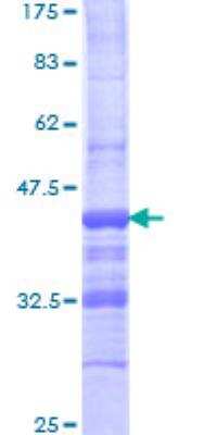 SDS-Page: Recombinant Human AE Binding Protein 1/ACLP Protein [H00000165-Q01] - 12.5% SDS-PAGE Stained with Coomassie Blue.