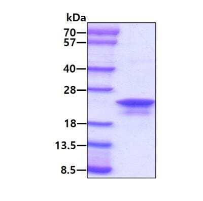 SDS-Page: Recombinant Human AG-2/AGR2 Protein [NBC1-18502] - 3ug by SDS-PAGE under reducing condition and visualized by coomassie blue stain.