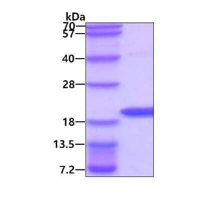 SDS-Page: Recombinant Human AG-3/AGR3 His Protein [NBP1-72342] - 3ug by SDS-PAGE under reducing condition and visualized by coomassie blue stain.