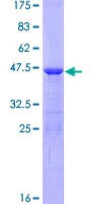 SDS-PAGE Recombinant Human AHNAK GST (N-Term) Protein