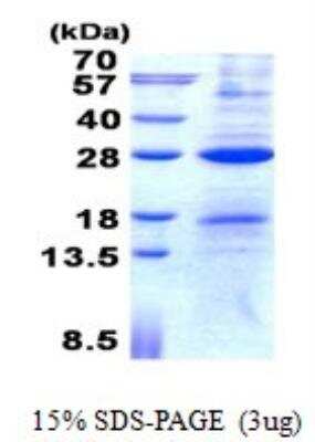 SDS-PAGE Recombinant Human AICDA His Protein