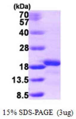 SDS-Page: Recombinant Human AIF1L Protein [NBP1-50962] - 15 % SDS-PAGE (3ug)