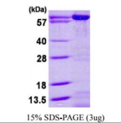 Recombinant Human AK5 Protein [NBP1-72502]