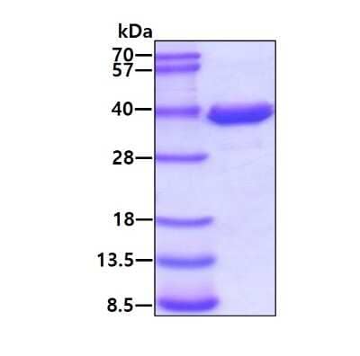 SDS-Page: Recombinant Human AKR1B1 Protein [NBC1-22925] - 3ug by SDS-PAGE under reducing condition and visualized by coomassie blue stain.