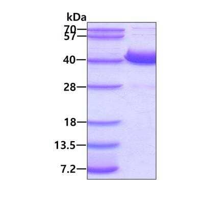 SDS-Page: Recombinant Human AKR1D1 His Protein [NBP1-51026] - 3ug by SDS-PAGE under reducing condition and visualized by coomassie blue stain.