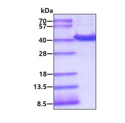 SDS-Page: Recombinant Human AKR7A3 Protein [NBP1-40394] - 3ug by SDS-PAGE under reducing condition and visualized by coomassie blue stain.