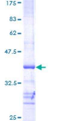 SDS-Page: Recombinant Human AKT2 Protein [H00000208-Q01] - 12.5% SDS-PAGE Stained with Coomassie Blue.