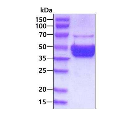 SDS-PAGE Recombinant Human AKT3 His Protein