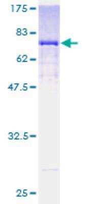 SDS-PAGE Recombinant Human ALDH3B1 GST (N-Term) Protein