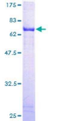 SDS-PAGE Recombinant Human ALDH3B2 GST (N-Term) Protein