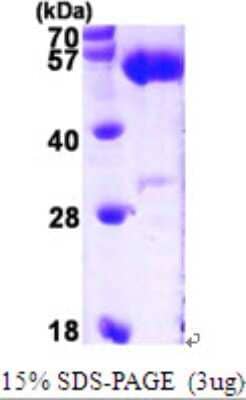 SDS-Page: Recombinant Human ALDH5A1 Protein [NBP1-48596] - 15 % SDS-PAGE (3ug)