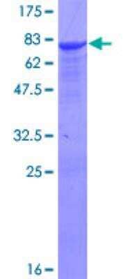 SDS-Page: Recombinant Human ALDH9A1 Protein [H00000223-P01] - 12.5% SDS-PAGE Stained with Coomassie Blue.