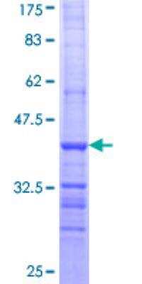SDS-Page: Recombinant Human ALDH9A1 Protein [H00000223-Q01] - 12.5% SDS-PAGE Stained with Coomassie Blue.