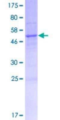 SDS-Page: Recombinant Human ALOX12P2 Protein [H00000245-P01] - 12.5% SDS-PAGE Stained with Coomassie Blue.