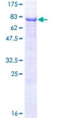 SDS-PAGE Recombinant Human ALPPL2 GST (N-Term) Protein