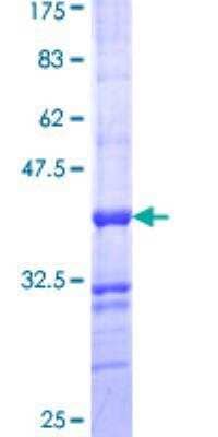 SDS-PAGE Recombinant Human ALPPL2 GST (N-Term) Protein