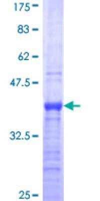 SDS-Page: Recombinant Human ALX3 Protein [H00000257-Q01] - 12.5% SDS-PAGE Stained with Coomassie Blue.