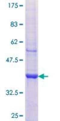 SDS-PAGE Recombinant Human AP1M2 GST (N-Term) Protein