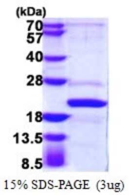 SDS-PAGE Recombinant Human AP1S2 His Protein