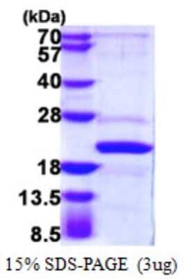 SDS-Page: Recombinant Human AP1S2 Protein [NBP1-72332] - 15% SDS-PAGE (3ug)