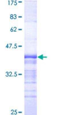 SDS-Page: Recombinant Human APBB2 Protein [H00000323-Q01] - 12.5% SDS-PAGE Stained with Coomassie Blue.