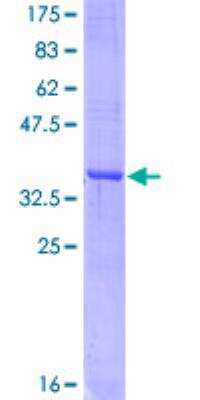 SDS-Page: Recombinant Human APLP-1 Protein [H00000333-Q01] - 12.5% SDS-PAGE Stained with Coomassie Blue.