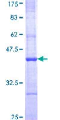 SDS-Page: Recombinant Human APOBEC1 Protein [H00000339-Q01] - 12.5% SDS-PAGE Stained with Coomassie Blue.