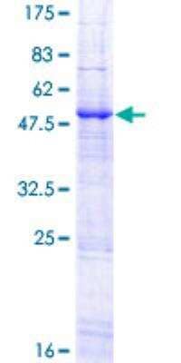 Recombinant Human APOBEC3B Protein [H00009582-P01] - 12.5% SDS-PAGE Stained with Coomassie Blue.