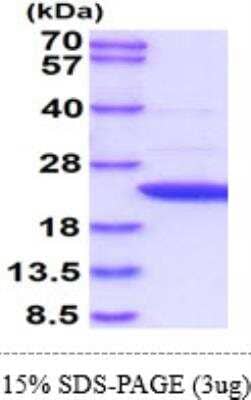 SDS-Page: Recombinant Human APRT Protein [NBP1-40402] - 15% SDS-Page