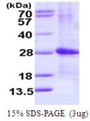 SDS-Page: Recombinant Human ARF4L Protein [NBP1-72493] - 15% SDS-PAGE (3ug)