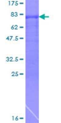 Recombinant Human ARFGAP1 Protein [H00055738-P02] - 12.5% SDS-PAGE Stained with Coomassie Blue.