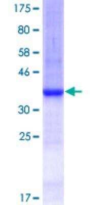 SDS-Page: Recombinant Human ARHGAP1 Protein [H00000392-Q01] - 12.5% SDS-PAGE Stained with Coomassie Blue.