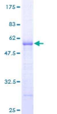SDS-Page: Recombinant Human ARHGDIG Protein [H00000398-P01] - 12.5% SDS-PAGE Stained with Coomassie Blue.