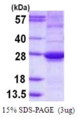 SDS-Page: Recombinant Human ARL15 Protein [NBP1-72497] - 15% SDS-PAGE (3ug)