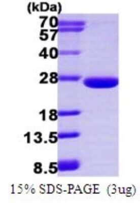 SDS-Page: Recombinant Human ARL3 Protein [NBP1-72464] - 15% SDS-PAGE (3ug)