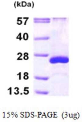 SDS-Page: Recombinant Human ARL5A Protein [NBP1-50900] - 15 % SDS-PAGE (3ug)