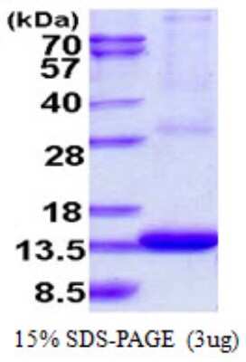 SDS-Page: Recombinant Human ARL9 Protein [NBP1-78836] - 15% SDS-PAGE (3ug)
