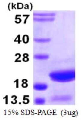 SDS-PAGE Recombinant Human ARPC5 His Protein