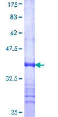 SDS-Page: Recombinant Human ARSE Protein [H00000415-Q01] - 12.5% SDS-PAGE Stained with Coomassie Blue.